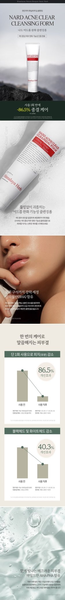 NARD Acne Clear Cleansing Foam 150ml